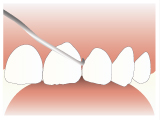 歯科検診3